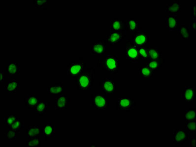 Immunofluorescence staining of Hela cells with CSB-PA010403OA34nbhbHU at 1:1, counter-stained with DAPI. The cells were fixed in 4% formaldehyde, permeabilized using 0.2% Triton X-100 and blocked in 10% normal Goat Serum. The cells were then incub...