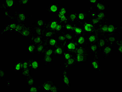 Immunofluorescence staining of Hela cells with CSB-PA010403OA34nhibHU at 1:1, counter-stained with DAPI. The cells were fixed in 4% formaldehyde, permeabilized using 0.2% Triton X-100 and blocked in 10% normal Goat Serum. The cells were then incub...