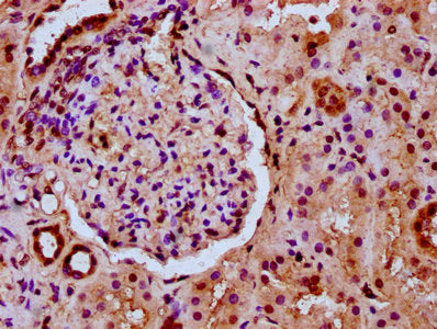 IHC image of CSB-PA010403OA36nogHU diluted at 1:20 and staining in paraffin-embedded human kidney tissue performed on a Leica BondTM system. After dewaxing and hydration, antigen retrieval was mediated by high pressure in a citrate buffer (pH 6.0)...