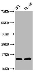 Western Blot Positive WB detected in: 293 whole cell lysate, HL60 whole cell lysate (all treated with 30mM sodium butyrate for 4h) All lanes: HIST1H2BC antibody at 1.7µg/ml Secondary Goat polyclonal to rabbit IgG at 1/50000 dilution Predicted band...