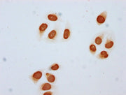 Immunocytochemistry analysis of CSB-PA010403OA85acHU diluted at 1:5 and staining in Hela cells (treated with 30mM sodium butyrate for 4h) performed on a Leica BondTM system. The cells were fixed in 4% formaldehyde, permeabilized using 0.2% Triton...