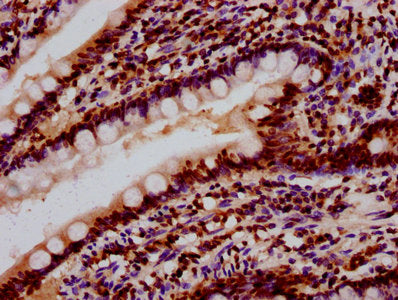 IHC image of CSB-PA010403OA85nsucHU diluted at 1:10 and staining in paraffin-embedded human small intestine tissue performed on a Leica BondTM system. After dewaxing and hydration, antigen retrieval was mediated by high pressure in a citrate buffe...