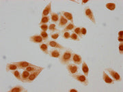 Immunocytochemistry analysis of CSB-PA010403PA05forHU diluted at 1:15 and staining in Hela cells(treated with 30mM sodium butyrate for 4h) performed on a Leica BondTM system. The cells were fixed in 4% formaldehyde, permeabilized using 0.2% Triton...
