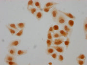 Immunocytochemistry analysis of CSB-PA010403PA108forHU diluted at 1:10 and staining in Hela cells(treated with 30mM sodium butyrate for 4h) performed on a Leica BondTM system. The cells were fixed in 4% formaldehyde, permeabilized using 0.2% Trito...