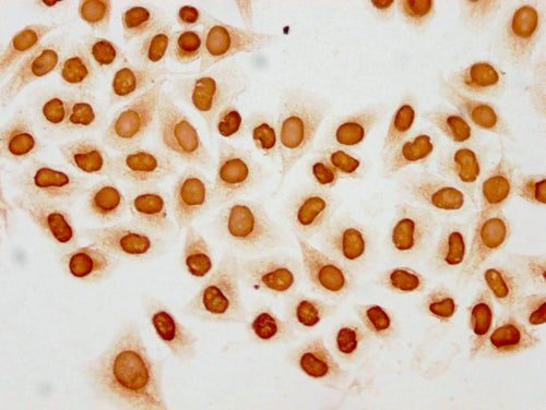 Immunocytochemistry analysis of CSB-PA010403PA20acHU diluted at 1:10 and staining in Hela cells(treated with 30mM sodium butyrate for 4h) performed on a Leica BondTM system. The cells were fixed in 4% formaldehyde, permeabilized using 0.2% Triton...
