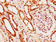 IHC image of CSB-PA010403PA20nacHU diluted at 1:10 and staining in paraffin-embedded human kidney tissue performed on a Leica BondTM system. After dewaxing and hydration, antigen retrieval was mediated by high pressure in a citrate buffer (pH 6.0)...