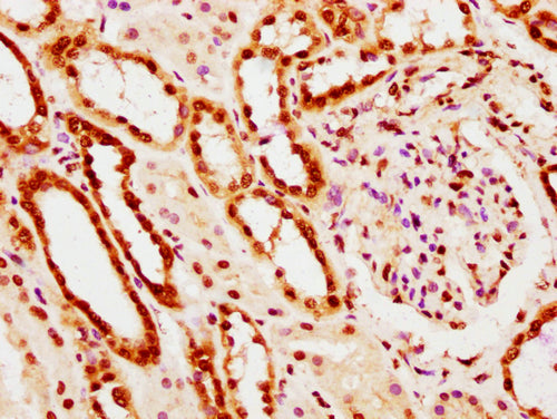 IHC image of CSB-PA010403PA20nacHU diluted at 1:10 and staining in paraffin-embedded human kidney tissue performed on a Leica BondTM system. After dewaxing and hydration, antigen retrieval was mediated by high pressure in a citrate buffer (pH 6.0)...