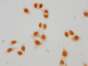 Immunocytochemistry analysis of CSB-PA010403PA23crHU diluted at 1:50 and staining in Hela cells(treated with 30mM sodium crotonylate for 4h) performed on a Leica BondTM system. The cells were fixed in 4% formaldehyde, permeabilized using 0.2% Trit...