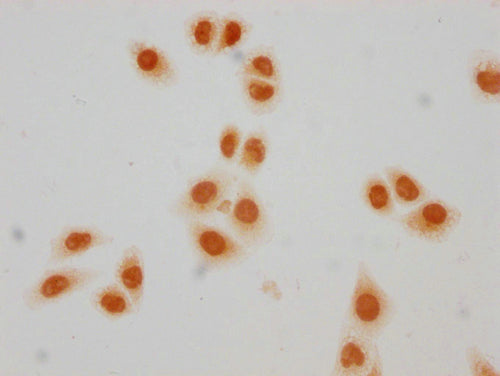 Immunocytochemistry analysis of CSB-PA010403PA23crHU diluted at 1:50 and staining in Hela cells(treated with 30mM sodium crotonylate for 4h) performed on a Leica BondTM system. The cells were fixed in 4% formaldehyde, permeabilized using 0.2% Trit...