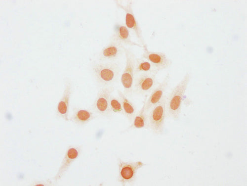 Immunocytochemistry analysis of CSB-PA010403PA23me1HU diluted at 1:15 and staining in Hela cells performed on a Leica BondTM system. The cells were fixed in 4% formaldehyde, permeabilized using 0.2% Triton X-100 and blocked with 10% normal goat se...