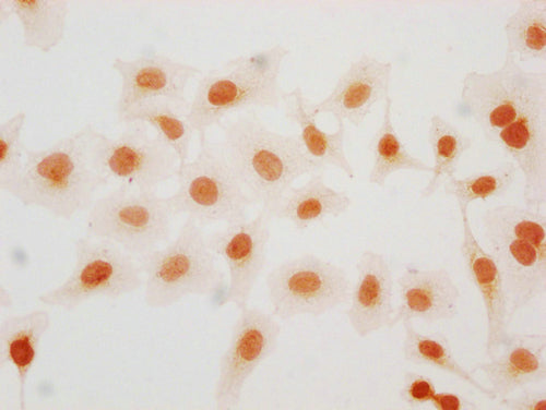 Immunocytochemistry analysis of CSB-PA010403PA57hibHU diluted at 1:15 and staining in Hela cells(treated with 30mM sodium butyrate for 4h) performed on a Leica BondTM system. The cells were fixed in 4% formaldehyde, permeabilized using 0.2% Triton...