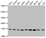 Western Blot Positive WB detected in: Hela whole cell lysate, Jurkat whole cell lysate, 293 whole cell lysate, A549 whole cell lysate, HepG2 whole cell lysate, K562 whole cell lysate, HL60 whole cell lysate, MCF-7 whole cell lysate, LO2 whole cell...