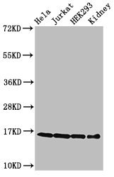 Western Blot Positive WB detected in: Hela cell acid extracts, Jurkat cell acid extracts, HEK293 cell acid extracts, Mouse kidney tissue All lanes: HIST1H3A antibody at 0.3µg/ml Secondary Goat polyclonal to rabbit IgG at 1/50000 dilution Predicted...