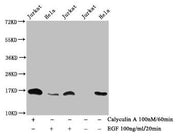 Western Blot Detected samples: Jurkat whole cell lysate, Hela whole cell lysate; Untreated (-) or treated (+) with Calyculin A and EGF All lanes: HIST1H3A antibody at 1:1000 Secondary Goat polyclonal to rabbit IgG at 1/40000 dilution Predicted ban...