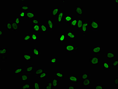 Immunofluorescence staining of Hela cells with CSB-PA010418OA04acHU at 1:7.5, counter-stained with DAPI. The cells were fixed in 4% formaldehyde, permeabilized using 0.2% Triton X-100 and blocked in 10% normal Goat Serum. The cells were then incub...