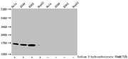 Western Blot Detected samples: Hela whole cell lysate, A549 whole cell lysate, K562 whole cell lysate, HepG2 whole cell lysate; Untreated (-) or treated (+) with 50mM sodium 3-hydroxybutyrate for 72h All lanes: HIST1H3A antibody at 1:2000 Secondar...