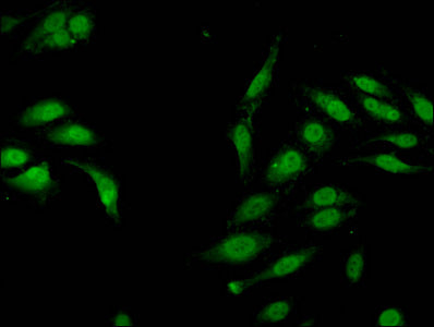 Immunofluorescent analysis of Hela cells using CSB-PA010418OA04me1HU at dilution of 1:100 and Alexa Fluor 488-congugated AffiniPure Goat Anti-Rabbit IgG(H+L)