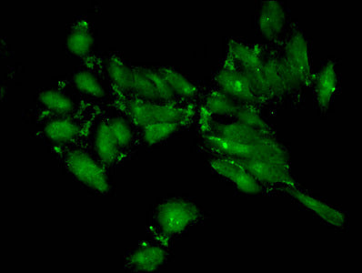 Immunofluorescent analysis of Hela cells using CSB-PA010418OA04me2HU at dilution of 1:100 and Alexa Fluor 488-congugated AffiniPure Goat Anti-Rabbit IgG(H+L)