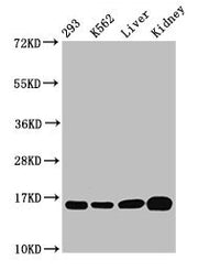 Western Blot Positive WB detected in: 293 whole cell lysate, K562 whole cell lysate, Rat liver tissue, Mouse kidney tissue All lanes: HIST1H3A antibody at 0.52µg/ml Secondary Goat polyclonal to rabbit IgG at 1/50000 dilution Predicted band size: 1...