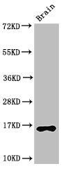 Western Blot Positive WB detected in: Mouse brain tissue All lanes: HIST1H3A antibody at 2.5µg/ml Secondary Goat polyclonal to rabbit IgG at 1/50000 dilution Predicted band size: 16 kDa Observed band size: 16 kDa
