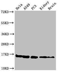 Western Blot Positive WB detected in: Hela cell acid extracts, A549 cell acid extracts, PC-3 cell acid extracts, Mouse kidney tissue, Mouse brain tissue All lanes: HIST1H3A antibody at 2µg/ml Secondary Goat polyclonal to rabbit IgG at 1/50000 dilu...