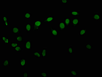 Immunofluorescence staining of Hela cells with CSB-PA010418OA06phHU at 1:10, counter-stained with DAPI. The cells were fixed in 4% formaldehyde, permeabilized using 0.2% Triton X-100 and blocked in 10% normal Goat Serum. The cells were then incuba...