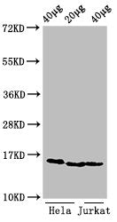 Western Blot Positive WB detected in: Hela cell acid extracts, Jurkat cell acid extracts All lanes: HIST1H3A antibody at 0.5µg/ml Secondary Goat polyclonal to rabbit IgG at 1/50000 dilution Predicted band size: 16 kDa Observed band size: 16 kDa