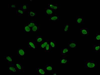 Immunofluorescent analysis of Hela cells using CSB-PA010418OA09me3HU at dilution of 1:100 and Alexa Fluor 488-congugated AffiniPure Goat Anti-Rabbit IgG(H+L)
