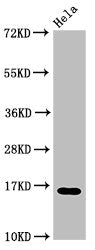Western Blot Positive WB detected in: Hela cell acid extracts All lanes: HIST1H3A antibody at 3µg/ml Secondary Goat polyclonal to rabbit IgG at 1/50000 dilution Predicted band size: 16 kDa Observed band size: 16 kDa