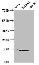 Western Blot Positive WB detected in: Hela cell acid extracts, Jurkat cell acid extracts, HEK293 cell acid extracts All lanes: HIST1H3A antibody at 1.5µg/ml Secondary Goat polyclonal to rabbit IgG at 1/50000 dilution Predicted band size: 16 kDa Ob...