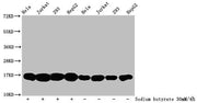 Western Blot Detected samples: Hela whole cell lysate, Jurkat whole cell lysate, 293 whole cell lysate, HepG2 whole cell lysate; Untreated (-) or treated (+) with 30mM sodium butyrate for 4h All lanes: HIST1H3A antibody at 1:500 Secondary Goat pol...