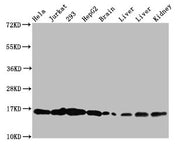 Western Blot Positive WB detected in: Hela whole cell lysate, Jurkat whole cell lysate, 293 whole cell lysate, HepG2 whole cell lysate, Rat brain tissue, Rat liver tissue, Mouse liver tissue, Mouse kidney tissue All lanes: HIST1H3A antibody at 0.3...