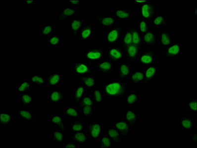 Immunofluorescence staining of Hela cells (treated with 30mM sodium butyrate for 4h) with CSB-PA010418OA14hibHU at 1:10, counter-stained with DAPI. The cells were fixed in 4% formaldehyde, permeabilized using 0.2% Triton X-100 and blocked in 10% n...