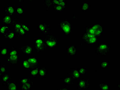 Immunofluorescence staining of MCF-7 cells with CSB-PA010418OA14nhibHU at 1:2.5, counter-stained with DAPI. The cells were fixed in 4% formaldehyde, permeabilized using 0.2% Triton X-100 and blocked in 10% normal Goat Serum. The cells were then in...