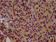 IHC image of CSB-PA010418OA14nsucHU diluted at 1:100 and staining in paraffin-embedded human glioma performed on a Leica BondTM system. After dewaxing and hydration, antigen retrieval was mediated by high pressure in a citrate buffer (pH 6.0). Sec...