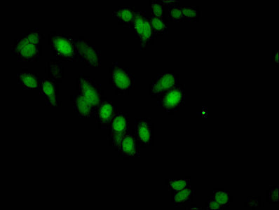 Immunofluorescent analysis of Hela cells using CSB-PA010418OA17me1HU at dilution of 1:100 and Alexa Fluor 488-congugated AffiniPure Goat Anti-Rabbit IgG(H+L)