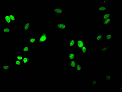 Immunofluorescent analysis of Hela cells using CSB-PA010418OA17me2HU at dilution of 1:100 and Alexa Fluor 488-congugated AffiniPure Goat Anti-Rabbit IgG(H+L)