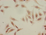 Immunocytochemistry analysis of Hela cells using CSB-PA010418OA18acHU at dilution of 1:100