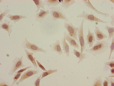 Immunocytochemistry analysis of Hela cells using CSB-PA010418OA18acHU at dilution of 1:100