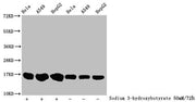 Western Blot Detected samples: Hela whole cell lysate, A549 whole cell lysate, HepG2 whole cell lysate; Untreated (-) or treated (+) with 50mM sodium 3-hydroxybutyrate for 72h All lanes: HIST1H3A antibody at 1:100 Secondary Goat polyclonal to rabb...
