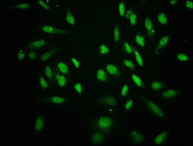 Immunofluorescence staining of Hela cells with CSB-PA010418OA18crHU at 1:25, counter-stained with DAPI. The cells were fixed in 4% formaldehyde, permeabilized using 0.2% Triton X-100 and blocked in 10% normal Goat Serum. The cells were then incuba...