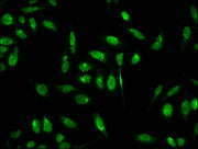 Immunofluorescence staining of Hela cells with CSB-PA010418OA18forHU at 1:7.5, counter-stained with DAPI. The cells were fixed in 4% formaldehyde, permeabilized using 0.2% Triton X-100 and blocked in 10% normal Goat Serum. The cells were then incu...