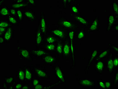 Immunofluorescence staining of Hela cells with CSB-PA010418OA18forHU at 1:7.5, counter-stained with DAPI. The cells were fixed in 4% formaldehyde, permeabilized using 0.2% Triton X-100 and blocked in 10% normal Goat Serum. The cells were then incu...