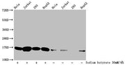 Western Blot Detected samples: Hela whole cell lysate, Jurkat whole cell lysate, 293 whole cell lysate, HepG2 whole cell lysate; Untreated (-) or treated (+) with 30mM sodium butyrate for 4h All lanes: HIST1H3A antibody at 1:500 Secondary Goat pol...