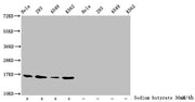 Western Blot Detected samples: Hela whole cell lysate, 293 whole cell lysate, A549 whole cell lysate, K562 whole cell lysate; Untreated (-) or treated (+) with 30mM sodium butyrate for 4h All lanes: HIST1H3A antibody at 1:2000 Secondary Goat polyc...