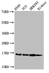 Western Blot Positive WB detected in: A549 cell acid extracts, PC-3 cell acid extracts, HEK293 cell acid extracts, Mouse kidney tissue All lanes: HIST1H3A antibody at 2µg/ml Secondary Goat polyclonal to rabbit IgG at 1/50000 dilution Predicted ban...