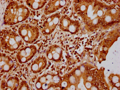 IHC image of CSB-PA010418OA23nbhbHU diluted at 1:20 and staining in paraffin-embedded human small intestine tissue performed on a Leica BondTM system. After dewaxing and hydration, antigen retrieval was mediated by high pressure in a citrate buffe...