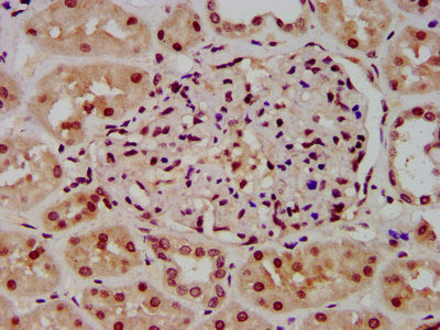 IHC image of CSB-PA010418OA23ncrHU diluted at 1:100 and staining in paraffin-embedded human kidney tissue performed on a Leica BondTM system. After dewaxing and hydration, antigen retrieval was mediated by high pressure in a citrate buffer (pH 6.0...