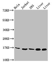 Western Blot Positive WB detected in: Hela whole cell lysate, Jurkat whole cell lysate, 293 whole cell lysate, Rat liver tissue, Mouse liver tissue All lanes: HIST1H3A antibody at 1.74µg/ml Secondary Goat polyclonal to rabbit IgG at 1/50000 diluti...
