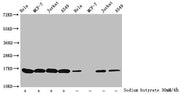 Western Blot Detected samples: Hela whole cell lysate, MCF-7 whole cell lysate, Jurkat whole cell lysate, A549 whole cell lysate; Untreated (-) or treated (+) with 30mM sodium butyrate for 4h All lanes: HIST1H3A antibody at 1:100 Secondary Goat po...